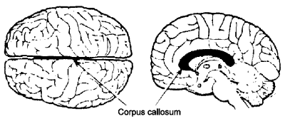 Two halves of the brain connected by the corpus callosum